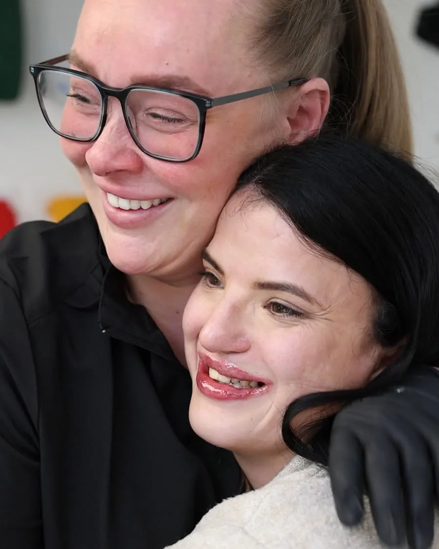 Gemma and a CleftInject client after her treatment